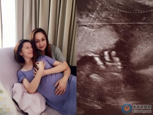 孕妇不易!徐若瑄输完液流血1个小时 浸透2层裤子