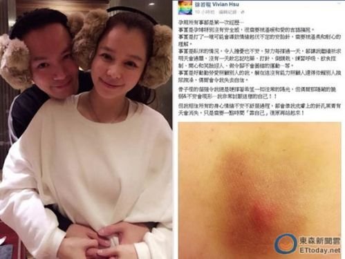 孕妇不易!徐若瑄输完液流血1个小时 浸透2层裤子