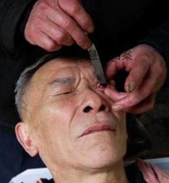 【转载】刀锋洗眼,这门古老的技艺几近失传,你见过吗?----好技术